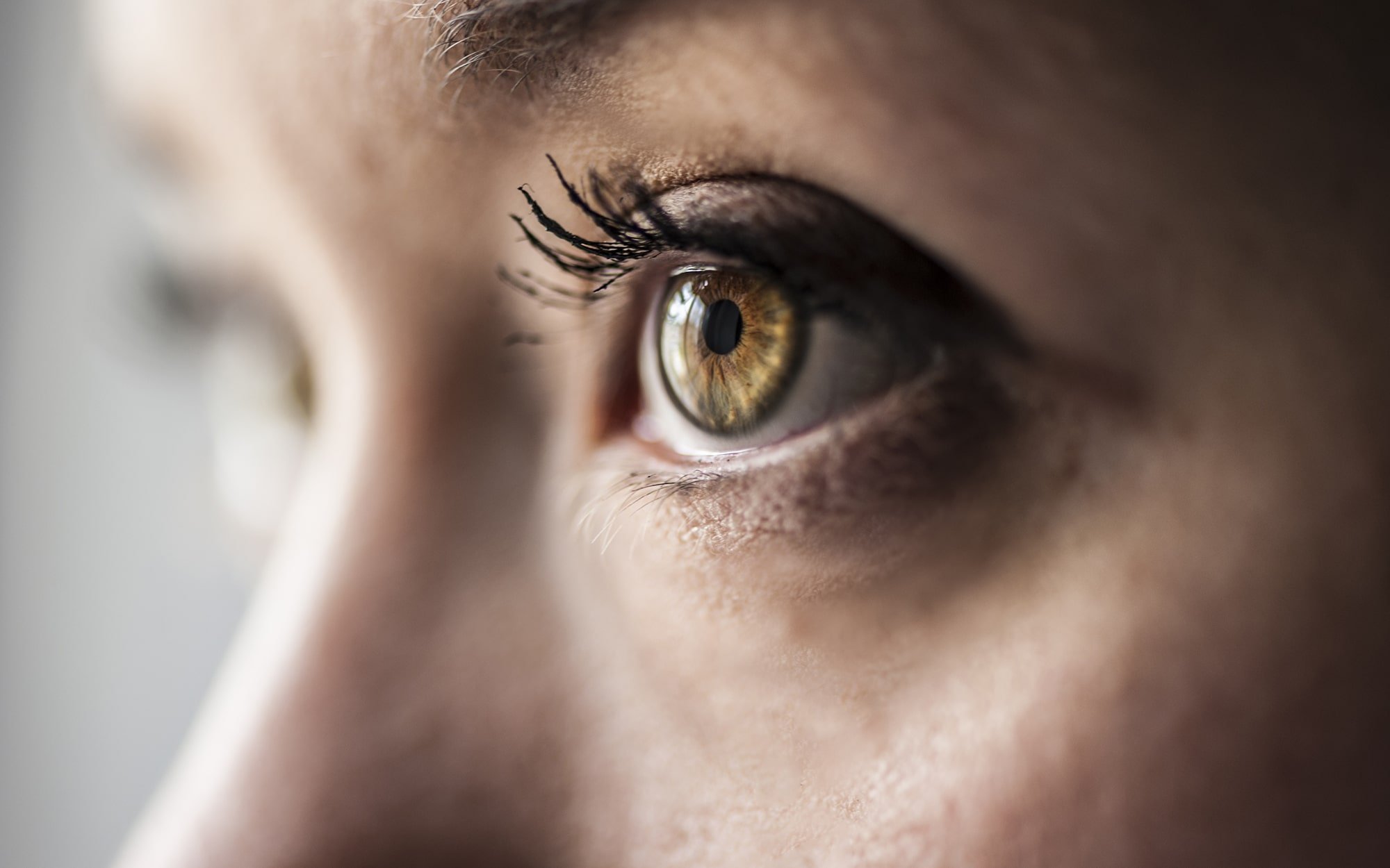 Myopie Hypermétropie Astigmatisme