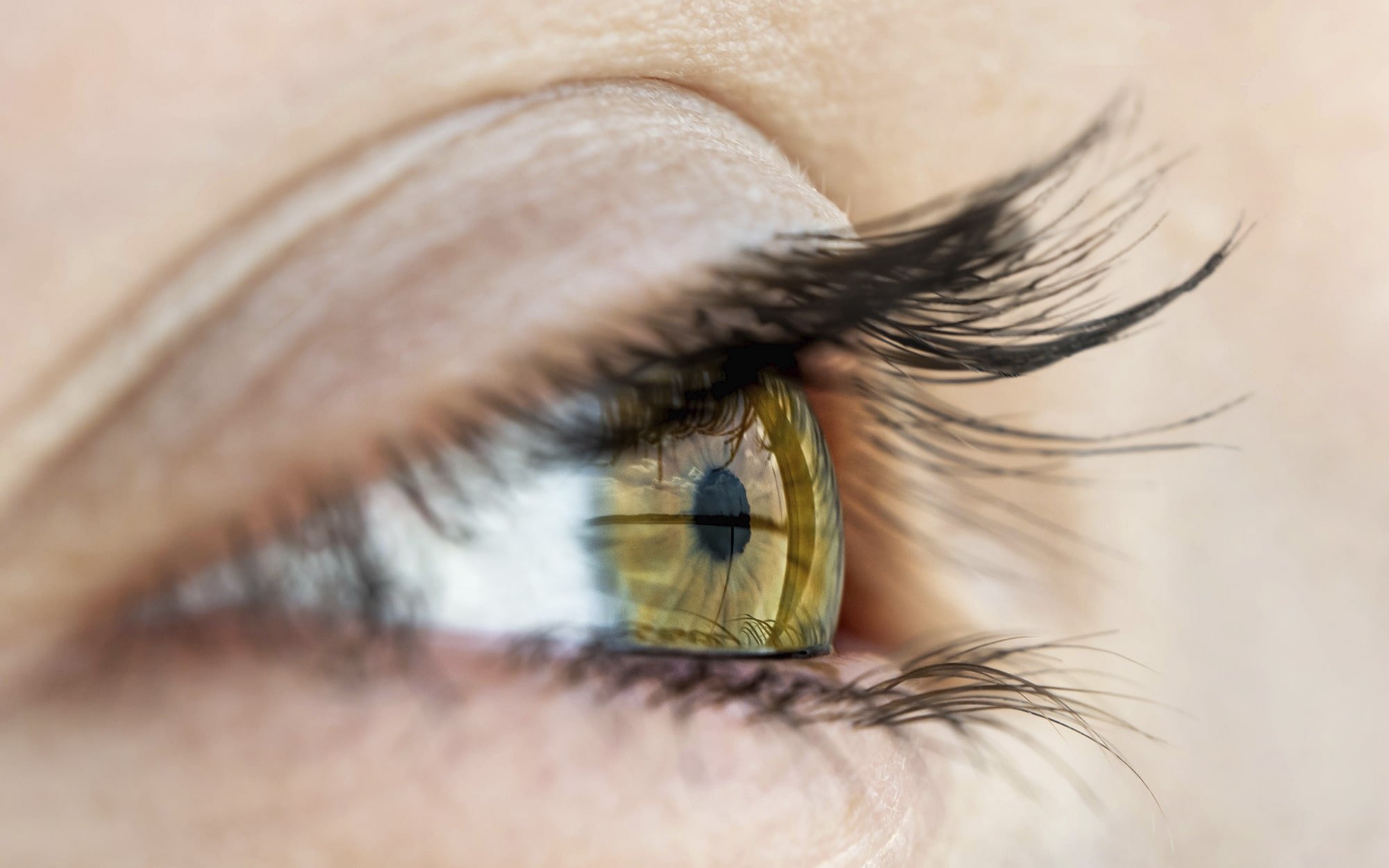 Les implants de la chirurgie cataracte