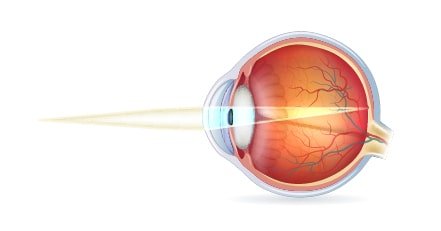 Vision normale