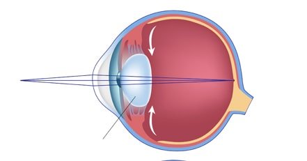 Vision normale